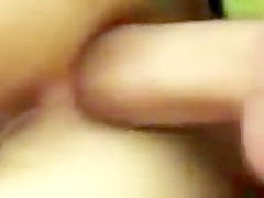 Anal fisting