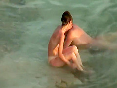 Sunburned woman is naked on a beach