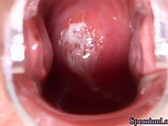 Speculum beauty peeing outdoors before internal teasing