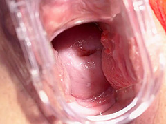 Gyno Car