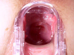 Gyno Car