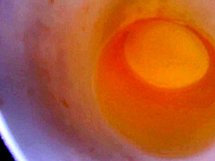 After Drinking A Drink I Piss In A Garden In Front Of Everyone!